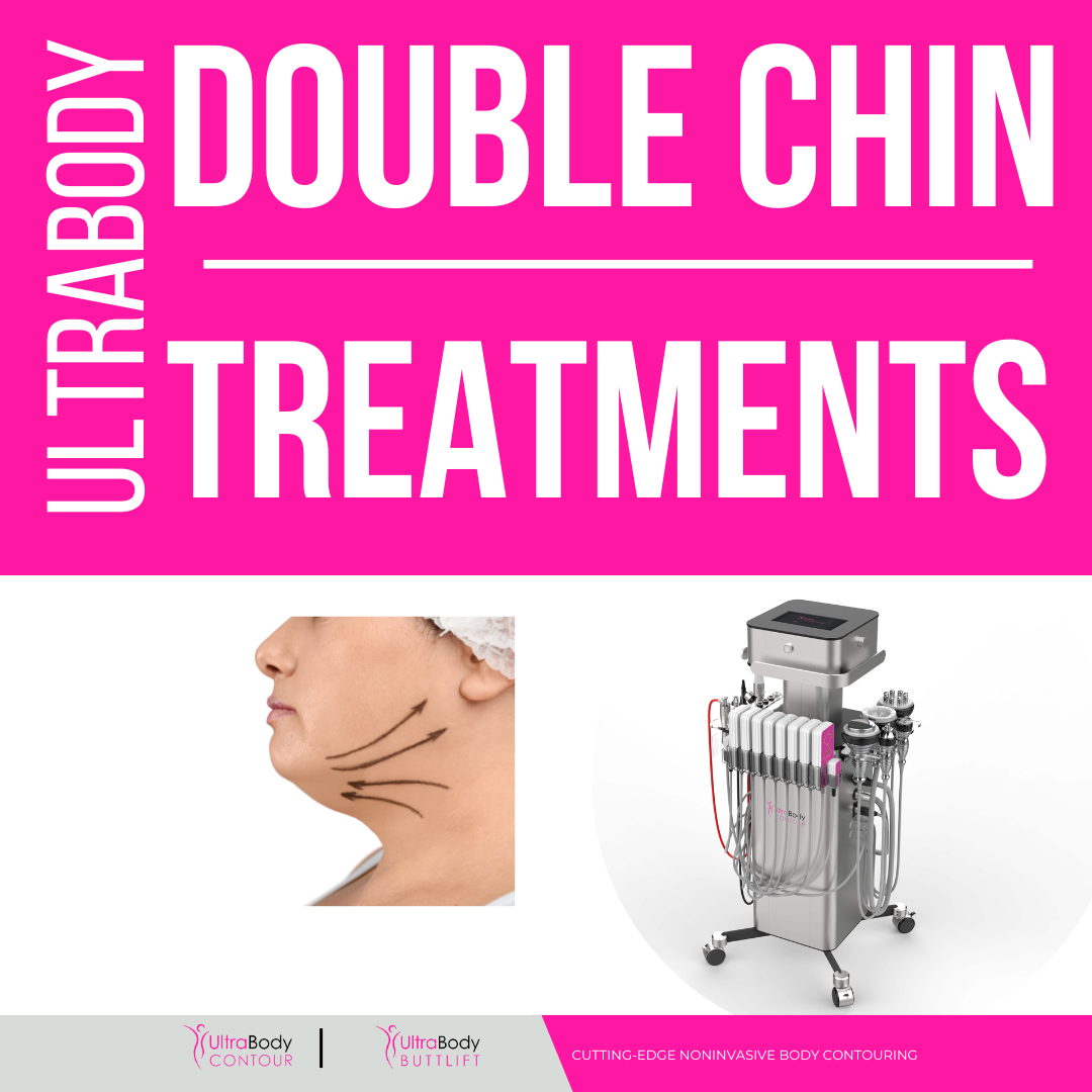 UltraBody Double Chin